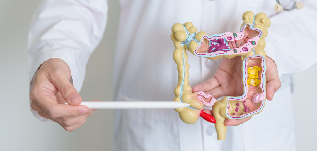 Integrative Perspectives in Ayurvedic Gut Health Management